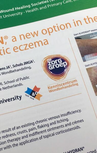 ALHYDRAN bij hypostatisch eczeem