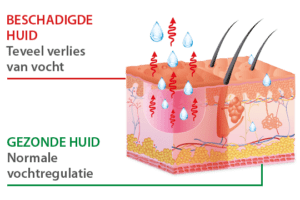 Gezonde huid VS beschadigde huid