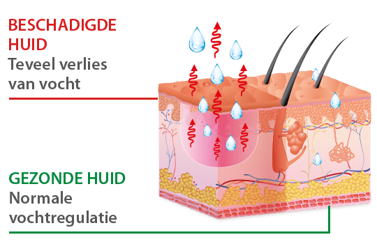 ALHYDRAN gezonde vs beschadigde huid