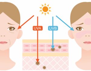 UVA en UVB-straling