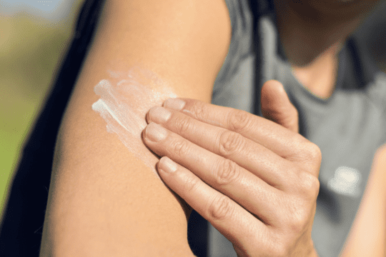 zonbescherming beschadigde huid en huidtype 1 en 2