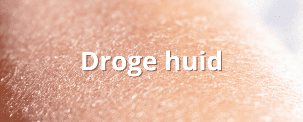 Droge huid