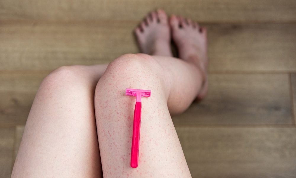 Jeuk na scheren benen