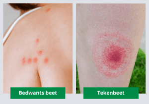 verschil bedwants beet en tekenbeet